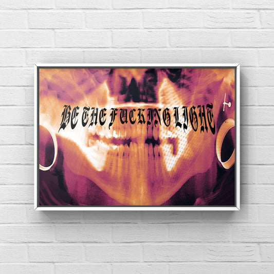 Teeth X-ray Print